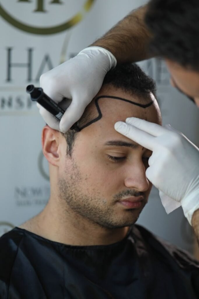 Best Hair Transplant in Mumbai