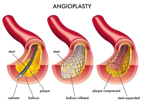 Best Cardiology Treatment India