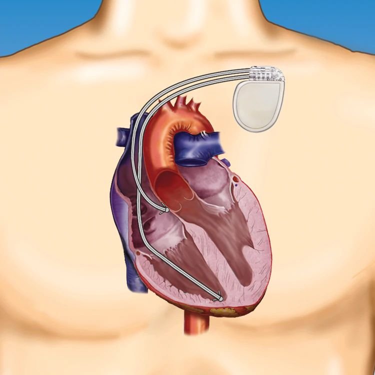 Best Cardiology Treatment India