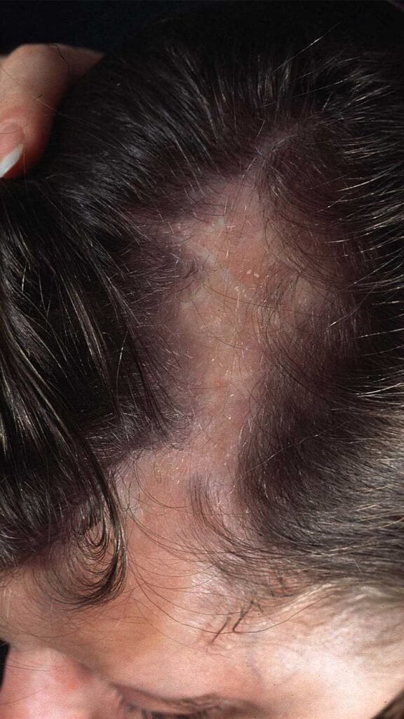 Best PRP Therapy Thane Mumbai