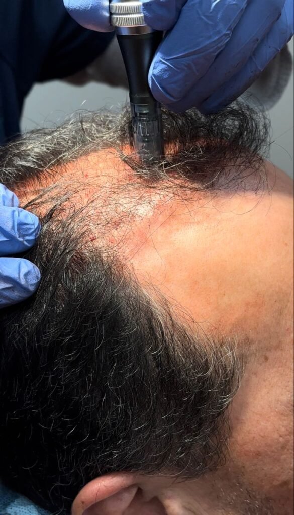 Hair-Loss Solutions Navi Mumbai