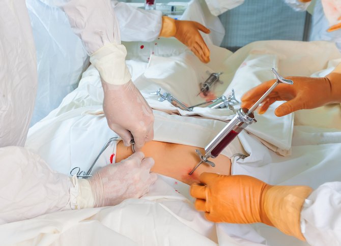 bone marrow transplant in navi mumbai
