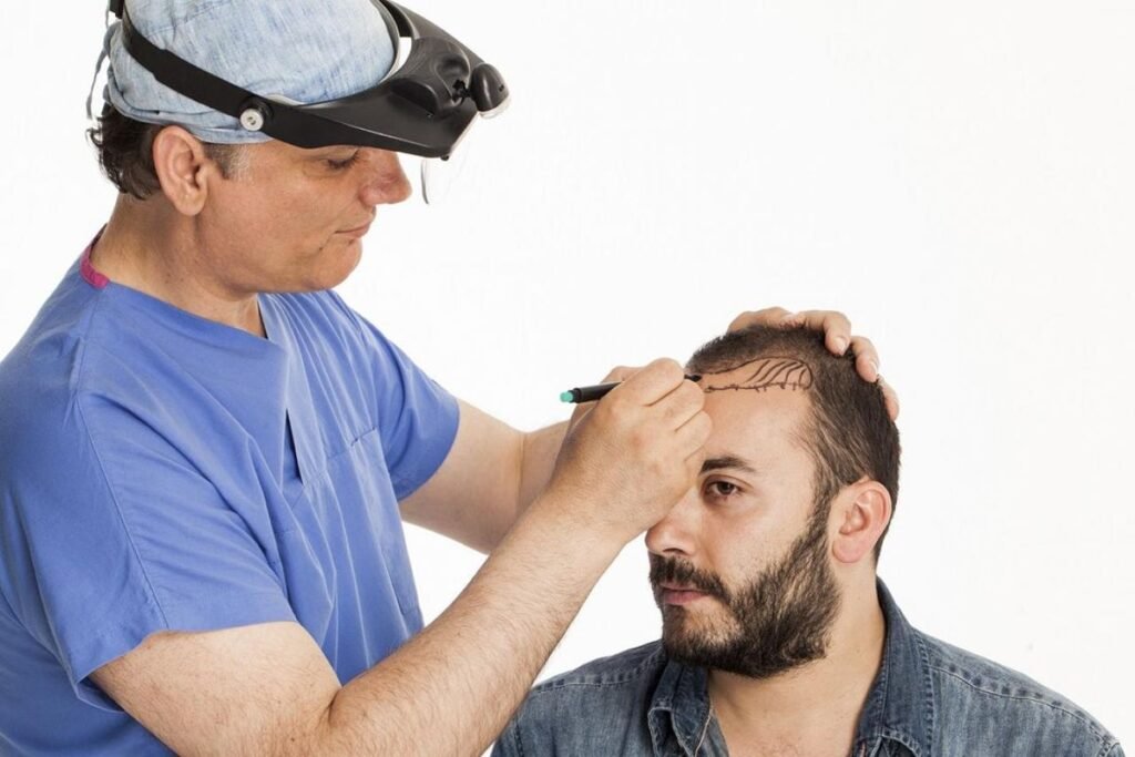 Affordable Hair Transplant india