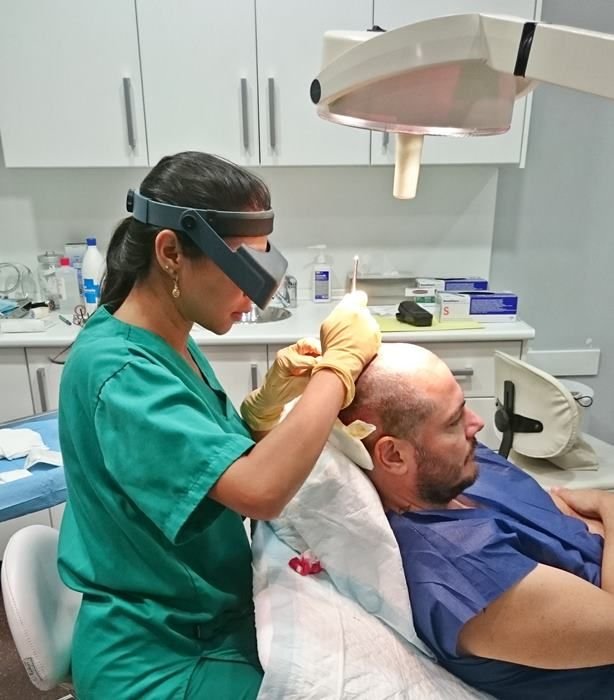 Affordable Hair Transplant India