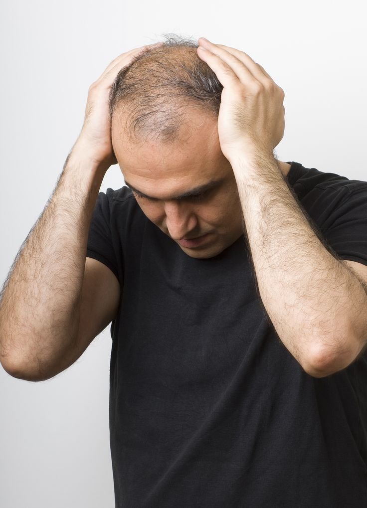 FUE Hair Transplant Bangkok